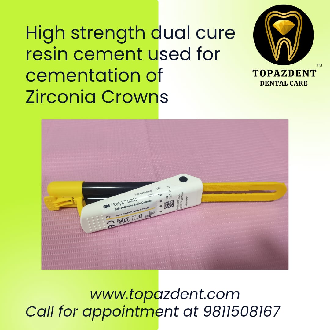 High Esthetic Zirconia Crowns