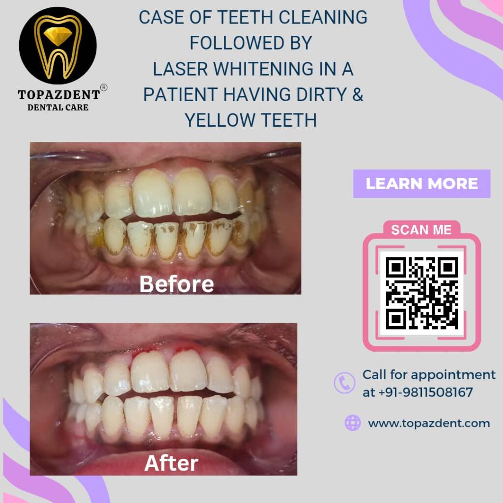 WhatsApp Image 2024-09-19 at 11.40.51 - Topazdent Dental Care Whatsapp Image 2024 09 19 At 11.40.51