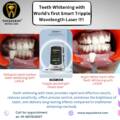 Achieve a Brighter Smile with Laser Teeth Whitening Using the World’s First Smart Triple Wavelength Laser at Topazdent Dental Care