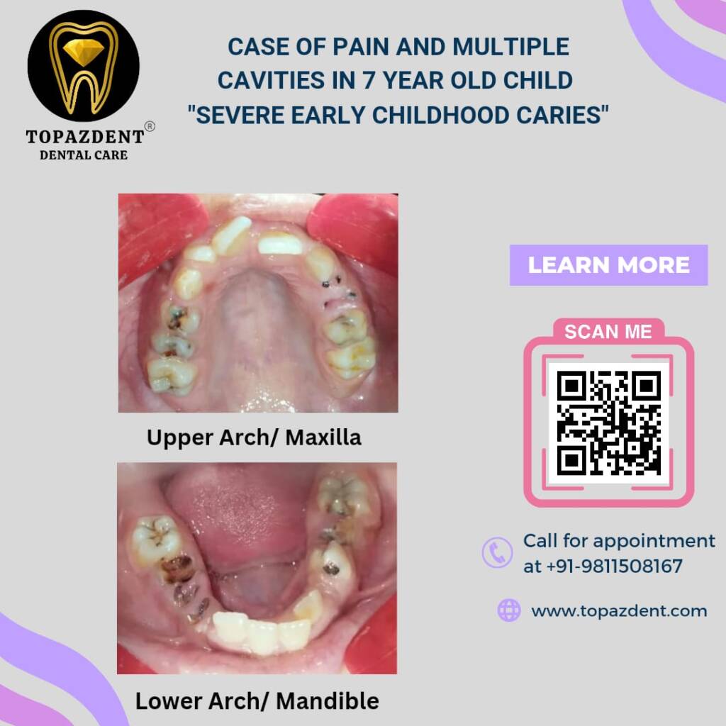 WhatsApp Image 2025-03-21 at 085745 - Topazdent Dental Care