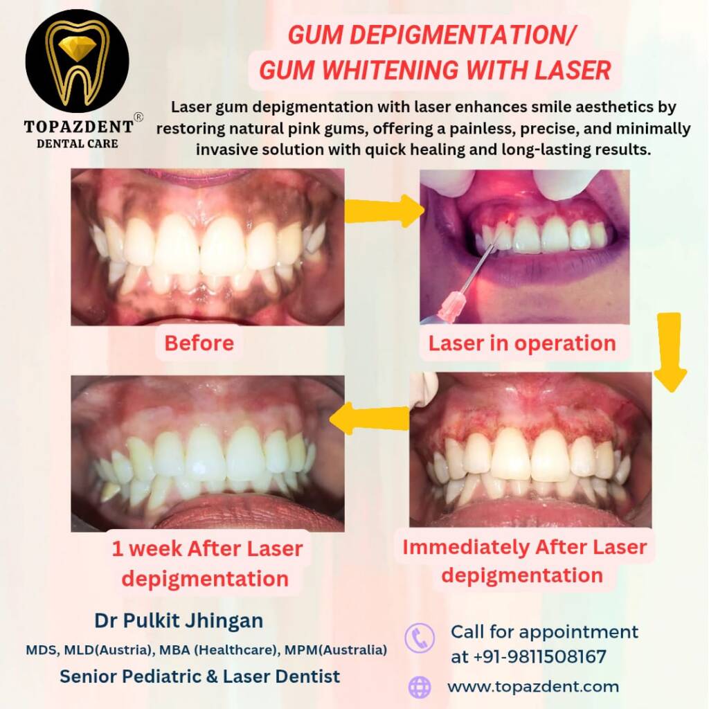depigmentation
